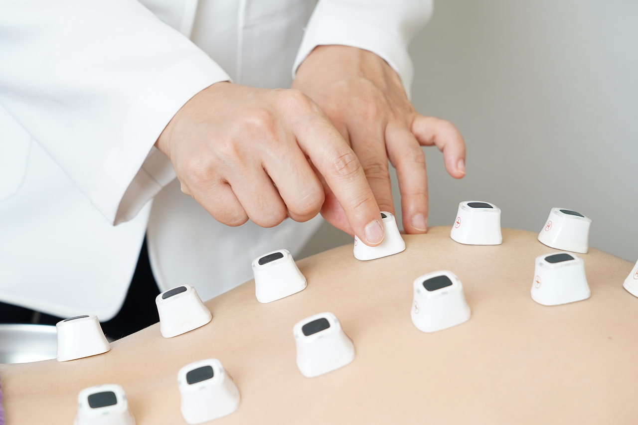 薄毛治療クリニックを選ぶための3条件とは？